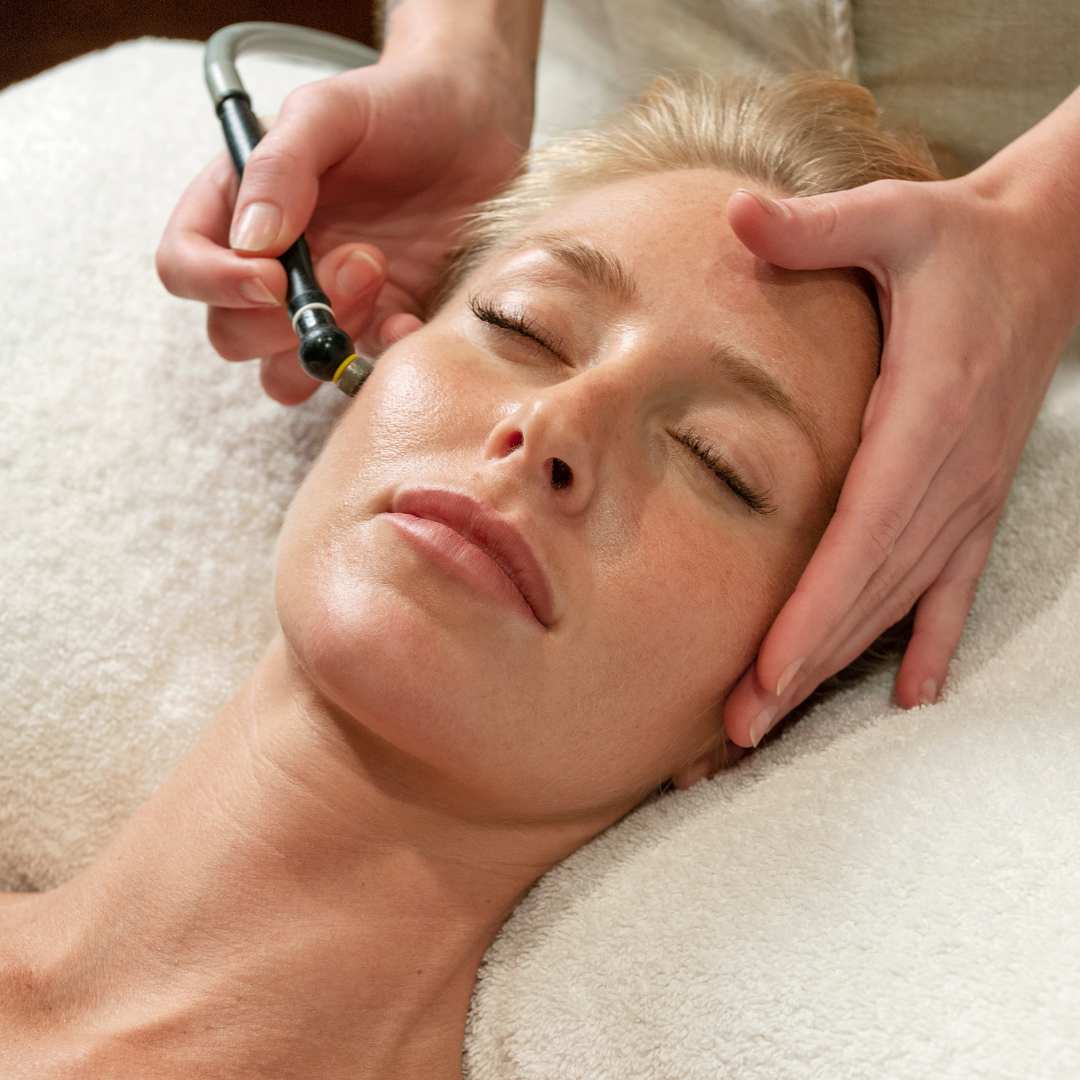 Microdermabrasion